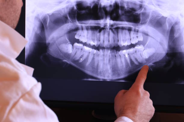 Best Emergency Dental Care for Broken or Chipped Teeth in Westmere, NY