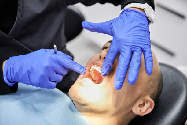 Best Emergency Treatment for Dental Infections or Abscesses in Westmere, NY